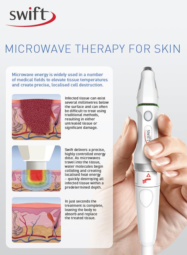SWIFT microwave therapy